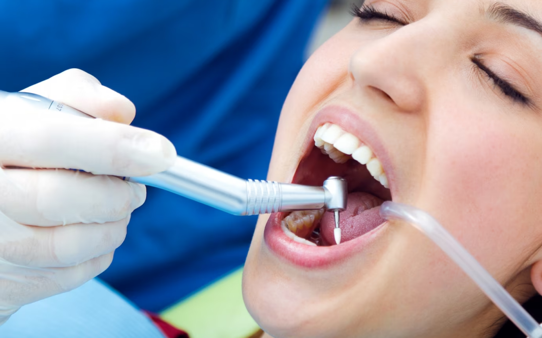 Trending Dental Treatments in 2023