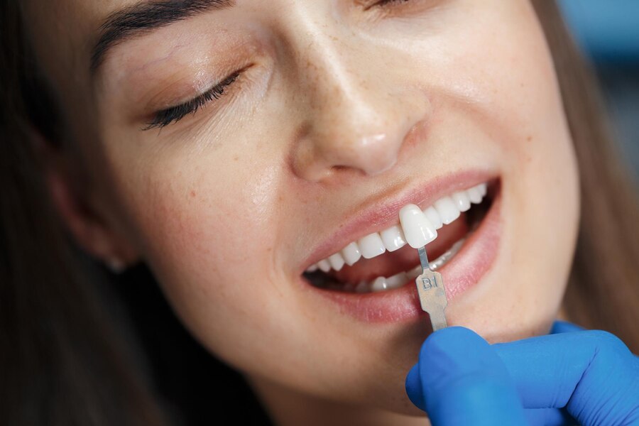 The Art of Dental Bonding: Repairing, Reshaping, and Renewing Your Teeth