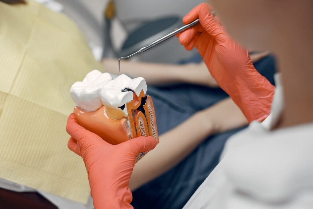 tooth model including root canal