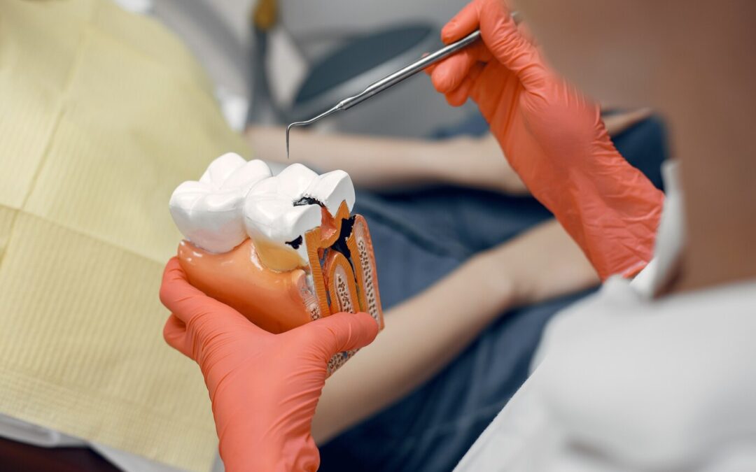 tooth model including root canal