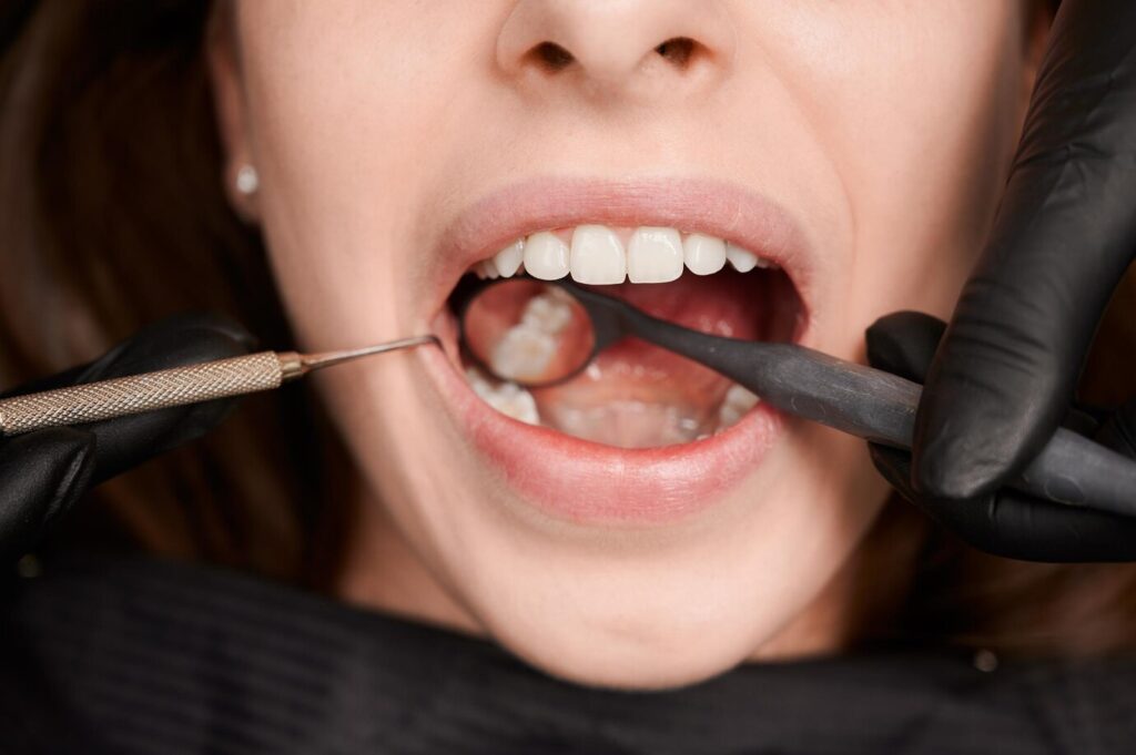 tooth enamel dentist check strength