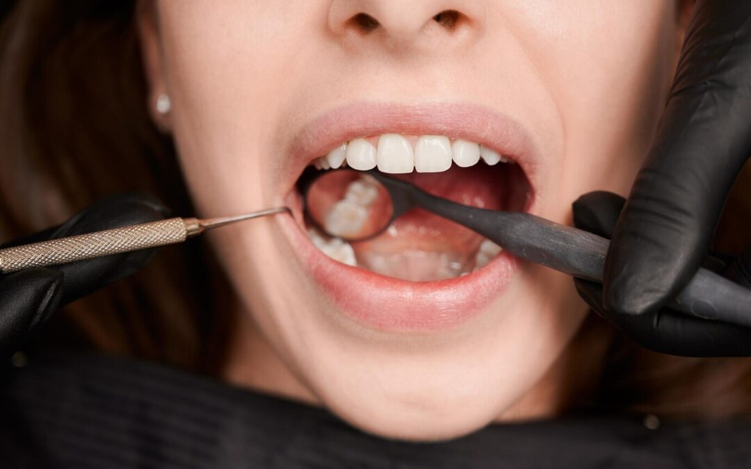 tooth enamel dentist check strength